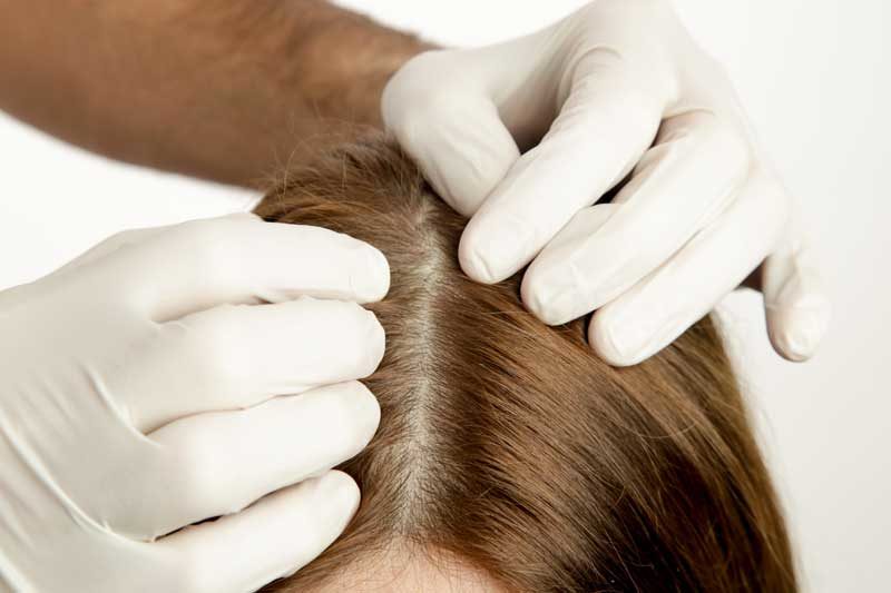 hair-loss-1139-1211876